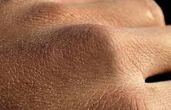 راههای مقابله با خشکی پوست دست در روزهای کرونایی